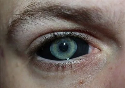 Tatuaj pe globul ocular