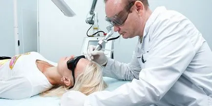 Eliminarea papiloamelor la domiciliu, mijloace și metode pentru medicamentoase cauterizare la clinică (papiloame) Eliminarea papiloame la domiciliu, medicamentele necesare și metode de cauterizare în clinica