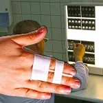 Contuzia degetul asupra simptomelor de mână, cauze, tratament, foto (deget) Contuzia degetul asupra simptomelor de mana, cauze, tratament, fotografii