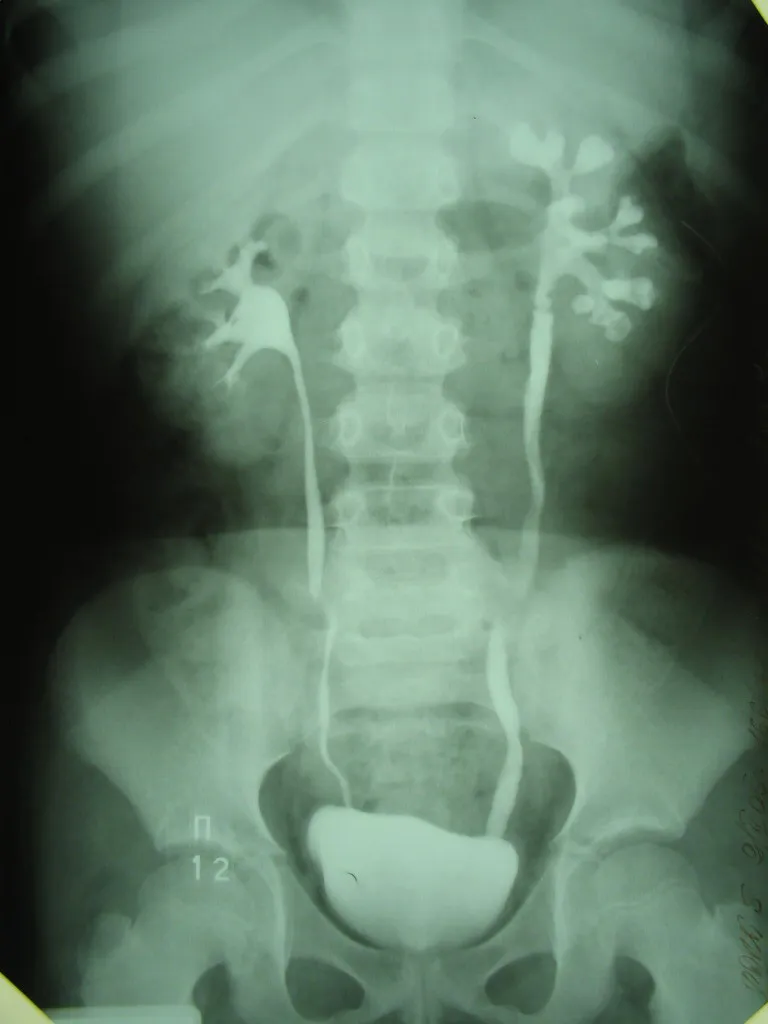 Tipuri de urografie, pregătire, conduita