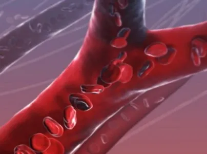 congestie venoasă în cap pentru a imbunatati fluxul de sange (venos) congestie venoasă în cap pentru a îmbunătăți fluxul de sânge
