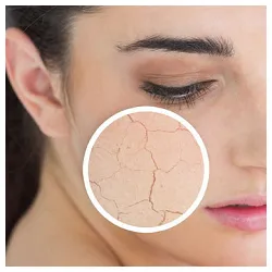 reducerea creme