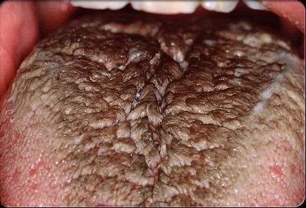 limba negru Hairy