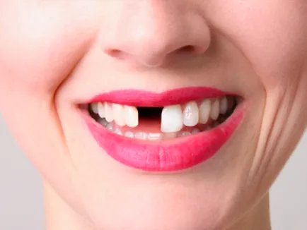 În vis, pentru a trata dintii vis a rezerva ceea ce visează un tratament dentar la dentist (tratate) În vis, pentru a trata dintii carte de vis ce visează un tratament dentar la dentist