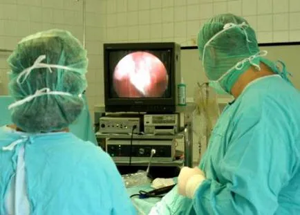cauzele chondromalacia genunchiului, simptomele, diagnosticul si tratamente (genunchi) chondromalacia genunchi cauze, simptome, diagnostic și tratamente