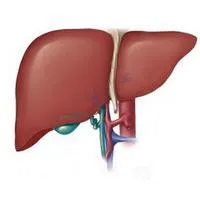 Icter (hepatita a)