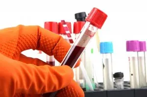 În analiza leucocitele sanguine a crescut În analiza leucocitele sanguine a crescut