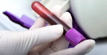 În analiza leucocitele sanguine a crescut În analiza leucocitele sanguine a crescut