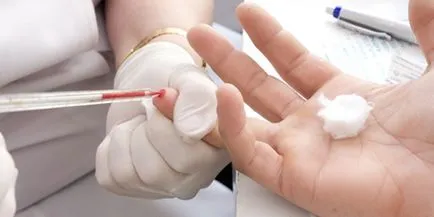 Un test de sânge pentru prepararea zahărului Un test de sânge pentru prepararea zahărului