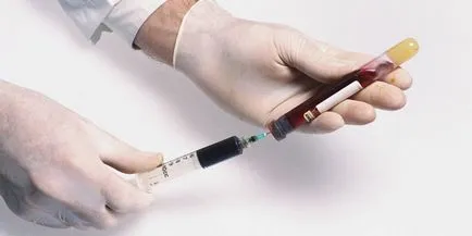 Un test de sânge pentru prepararea zahărului Un test de sânge pentru prepararea zahărului