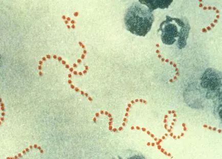 Angina decât antibioticele de vindecare