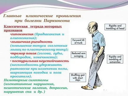 akinesia ce akinesia ce