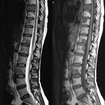 Care este spațiul perivascular