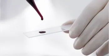 Cum de a crește hemoglobina droguri