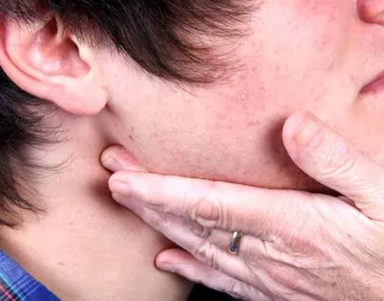 nodul limfatic inflamată decât vindecarea