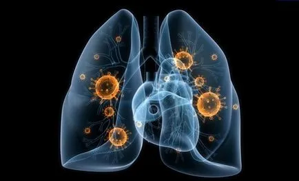 infecții pulmonare infecții pulmonare