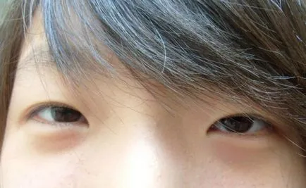 Epicanthus ce este