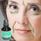 ADN-ul Gardnerella vaginalis l ADN-ul Gardnerella vaginalis l