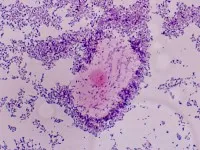 ADN-ul Gardnerella vaginalis l