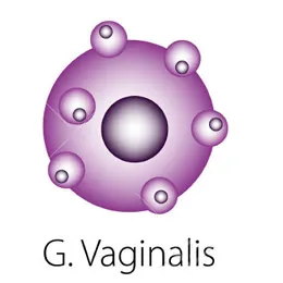 ADN-ul Gardnerella vaginalis l ADN-ul Gardnerella vaginalis l