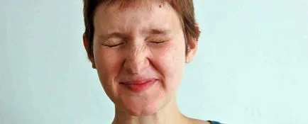 tratament amărăciune tratament amărăciune
