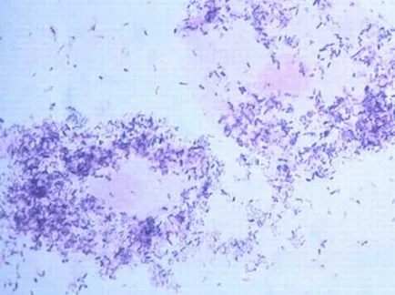 ADN-ul Gardnerella vaginalis l ADN-ul Gardnerella vaginalis l