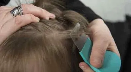 Cum să scapi de păduchi într-un copil Cum să scapi de păduchi într-un copil