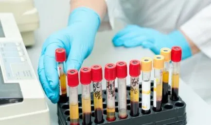 Un test de sânge pentru prepararea zahărului