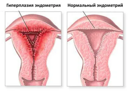 Din ceea ce poate fi secretie sangvinolenta