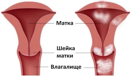 Din ceea ce poate fi secretie sangvinolenta