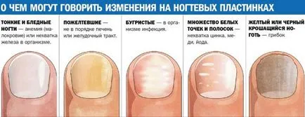 Din ceea ce striate cuie Din ceea ce striate cuie