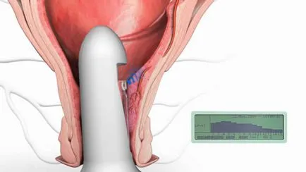 Cum gadget-uri