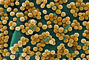 Staphylococcus aureus ce este