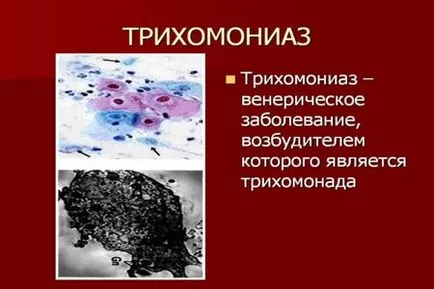 Schema de tratament trihomoniaza