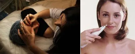 Cum de a elimina parul Cum de a elimina parul
