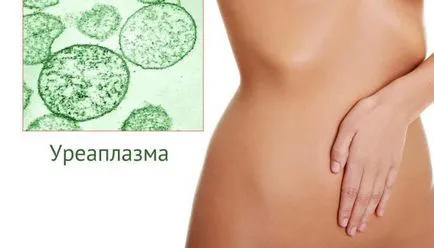 Ureaplasmosis cum să trateze