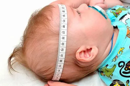 Presiune intracraniană la sugari tratate