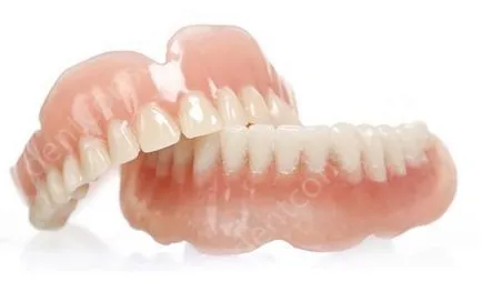 Proteza sau implantare Proteza sau implantare