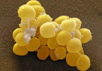 Staphylococcus aureus ce este