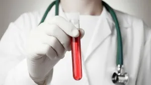 Analiza numire biochimie sânge, pregătire, proceduri și decodificare a rezultatelor studiului