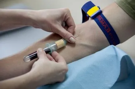 Analiza creatininei din sânge atât treci și decriptarea (produs rezidual de schimb) Un test de sânge pentru a creatininei, ca trece și interpretarea