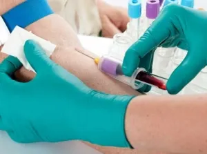 Analiza biochimică a sângelui - norma, descifrarea analiza biochimică a sângelui
