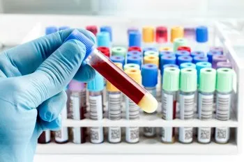 Analiza biochimică a sângelui - un studiu complet al unui organism (sânge) Analiza biochimică a sângelui - un studiu complet al unui organism