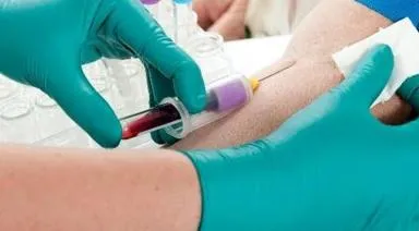 Analiza biochimică a sângelui și rata rezultatelor de decodare la adulți