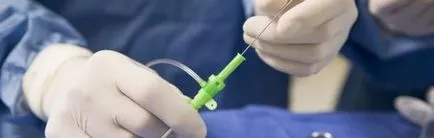 Biopsia și rolul său în diagnosticul și tratamentul cancerului