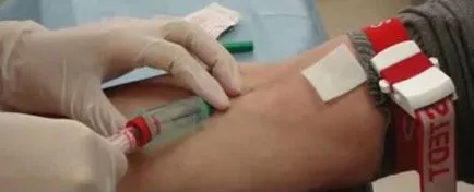 Biochimia sângelui că este indicatorii ca norma de a dona sânge