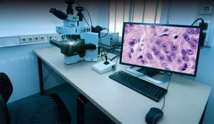 Biopsia de san este citit, decodarea și tipuri de biopsii