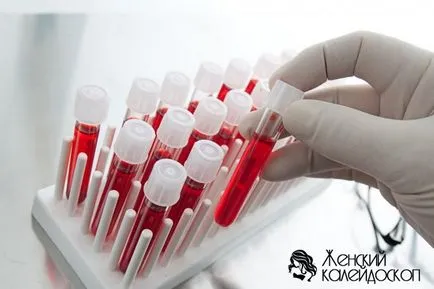Analiza biochimică a sângelui - un studiu complet al unui organism (biochimic) Analiza biochimică a sângelui - un studiu complet al unui organism