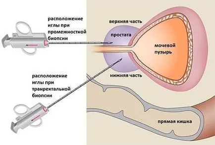 Biopsia și rolul său în diagnosticul și tratamentul cancerului