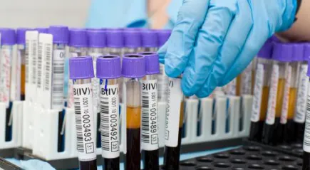 Analiza biochimică a decodificare sângelui, rata Analiza biochimică a decodificare sângelui, rata